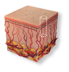 DeepFX - deep penetration pulse profile