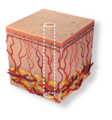 SCAARFX penetration profile - deepest penetration in a single pulse