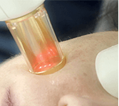 Treatment_4
